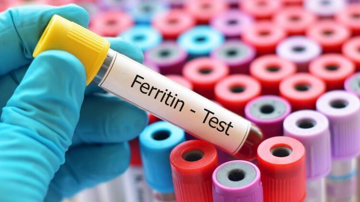 Blood sample being tested for ferritin and iron levels