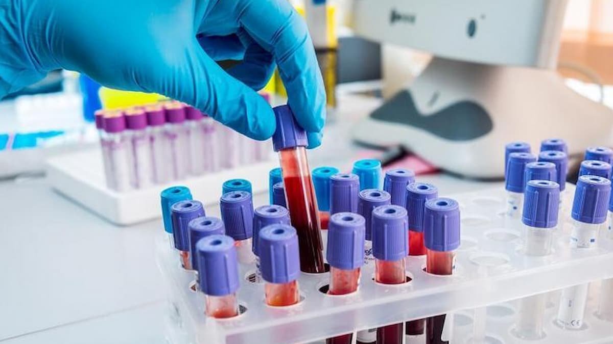 Blood test tubes used to measure ferritin and iron levels